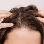 Hair & scalp concerns