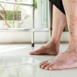 ⁠Poor circulation