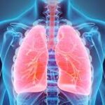 Breathlessness & low lung capacity