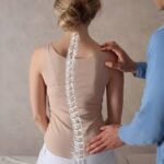 ⁠Scoliosis & posture-related curves