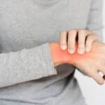 ⁠Nerve compression & tingling